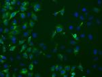 PRKAR1A Antibody in Immunocytochemistry (ICC/IF)