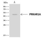 PRKAR1A Antibody in Immunoprecipitation (IP)