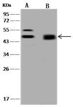 PRKAR1A Antibody in Western Blot (WB)