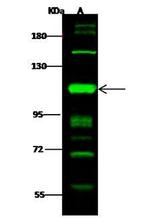 PRKD2 Antibody in Western Blot (WB)