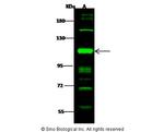 PRKD2 Antibody in Western Blot (WB)