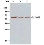 PRMT6 Antibody in Immunoprecipitation (IP)