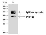 PRPF18 Antibody in Immunoprecipitation (IP)