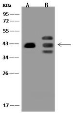 PRPF18 Antibody in Western Blot (WB)