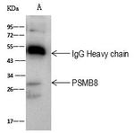 PSMB8 Antibody in Immunoprecipitation (IP)