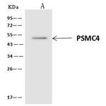 PSMC4 Antibody in Immunoprecipitation (IP)