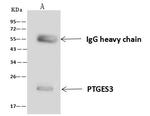 p23 Antibody in Immunoprecipitation (IP)