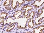 RAB27A Antibody in Immunohistochemistry (Paraffin) (IHC (P))