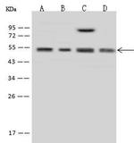 MINA53 Antibody in Western Blot (WB)