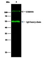 SEMA4A Antibody in Immunoprecipitation (IP)