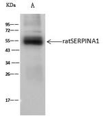 alpha-1 Antitrypsin Antibody in Immunoprecipitation (IP)