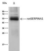 alpha-1 Antitrypsin Antibody in Immunoprecipitation (IP)