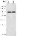 alpha-1 Antitrypsin Antibody in Western Blot (WB)