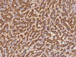 ORNT1 Antibody in Immunohistochemistry (Paraffin) (IHC (P))