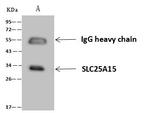 ORNT1 Antibody in Immunoprecipitation (IP)