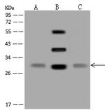 ORNT1 Antibody in Western Blot (WB)