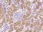 EBP50 Antibody in Immunohistochemistry (Paraffin) (IHC (P))