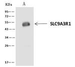 EBP50 Antibody in Immunoprecipitation (IP)