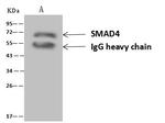 SMAD4 Antibody in Immunoprecipitation (IP)