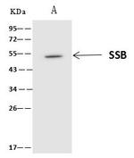 SSB Antibody in Immunoprecipitation (IP)