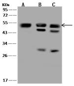 SSB Antibody in Western Blot (WB)