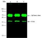 STUB1 Antibody in Immunoprecipitation (IP)