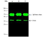 STUB1 Antibody in Immunoprecipitation (IP)