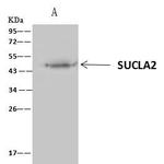 SUCLA2 Antibody in Immunoprecipitation (IP)