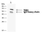 TAB1 Antibody in Immunoprecipitation (IP)