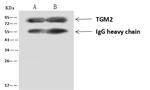 TGM2 Antibody in Immunoprecipitation (IP)