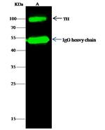 Tyrosine Hydroxylase Antibody in Immunoprecipitation (IP)