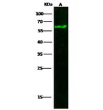 Tyrosine Hydroxylase Antibody in Western Blot (WB)