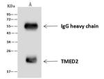 TMED2 Antibody in Immunoprecipitation (IP)