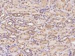 TRAP1 Antibody in Immunohistochemistry (Paraffin) (IHC (P))