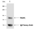 TRAP1 Antibody in Immunoprecipitation (IP)