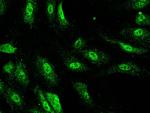 TRIM37 Antibody in Immunocytochemistry (ICC/IF)