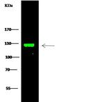 TRIM37 Antibody in Western Blot (WB)