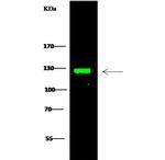 TRIM37 Antibody in Western Blot (WB)