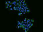 TST Antibody in Immunocytochemistry (ICC/IF)