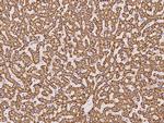 TST Antibody in Immunohistochemistry (Paraffin) (IHC (P))