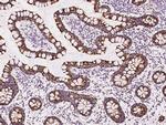 TST Antibody in Immunohistochemistry (Paraffin) (IHC (P))