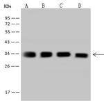 TST Antibody in Western Blot (WB)