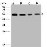 TXNDC5 Antibody in Western Blot (WB)