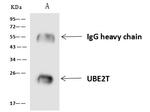 UBE2T Antibody in Immunoprecipitation (IP)