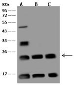 UBE2T Antibody in Western Blot (WB)