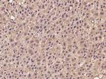 UEVLD Antibody in Immunohistochemistry (Paraffin) (IHC (P))