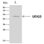 UEVLD Antibody in Immunoprecipitation (IP)