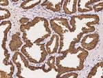 UGDH Antibody in Immunohistochemistry (Paraffin) (IHC (P))