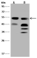 UGP2 Antibody in Western Blot (WB)