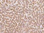 UQCRB Antibody in Immunohistochemistry (Paraffin) (IHC (P))